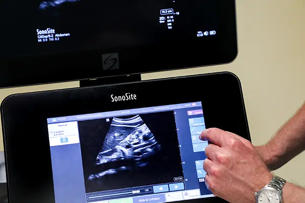 Workshop - POCUS